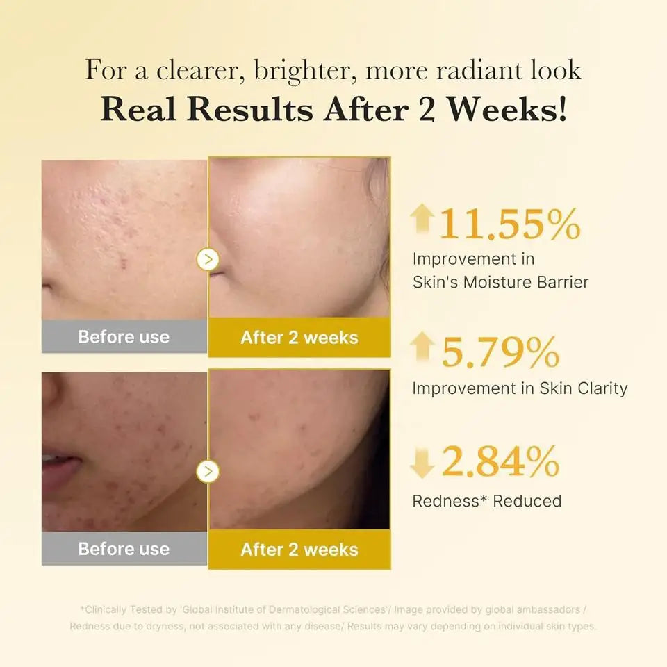 Turmeric Face Serum Repair Melanin Freckle Pigment Correcting Brighten Lightening Moisturizer Nourish Smooth Shrink Pore Essence Qme