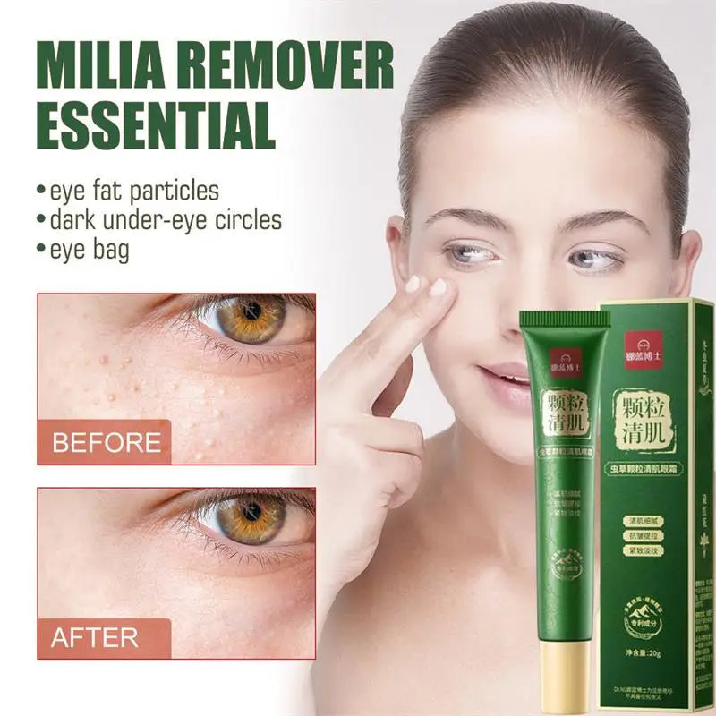 Fat Granules Remover Eye Cream Anti-Puffiness Anti Inflammatory Reduce Dark Circles Eyebags Fade Lines Moisturizing Eye Care Qme