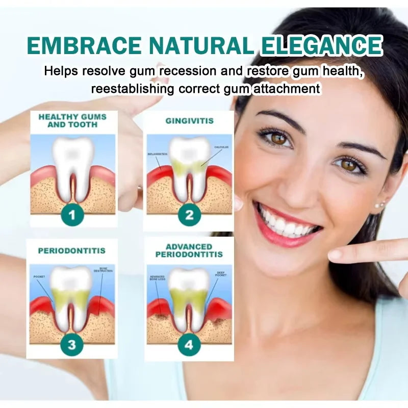 Damaged Gum Repair Care Gel Relieve Sore Gums Allergy Deep Cleaning Teeth Stains Tartar Serum Dental Caries Toothpaste Qme