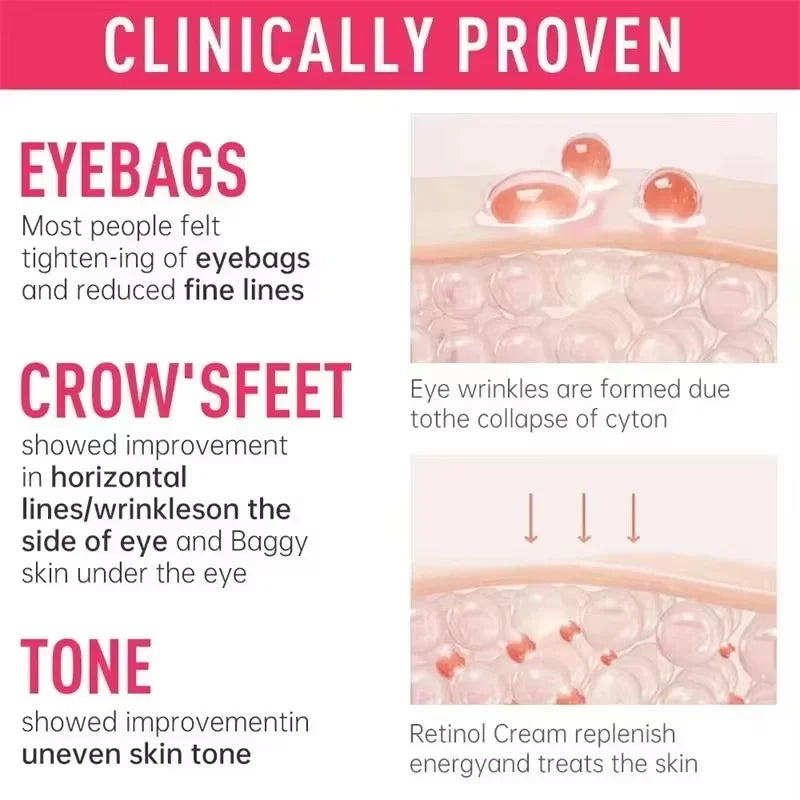 Instant Eye Bag Removal Cream Collagen Anti-Wrinkle Firming Skin Fade Fine Lines Anti Dark Circle Puffiness Brighten Eye Care Qme