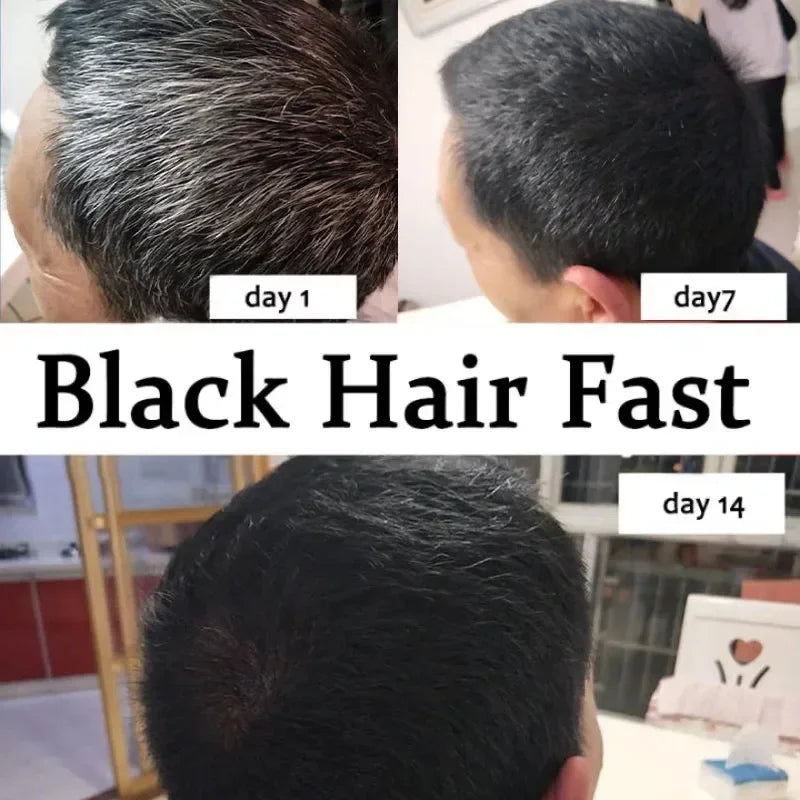 Gray White Hair Treatment Serum Cover White Hair To Black Natural Color Repair Spray Anti Loss Hair Restore Healthy Care Qme