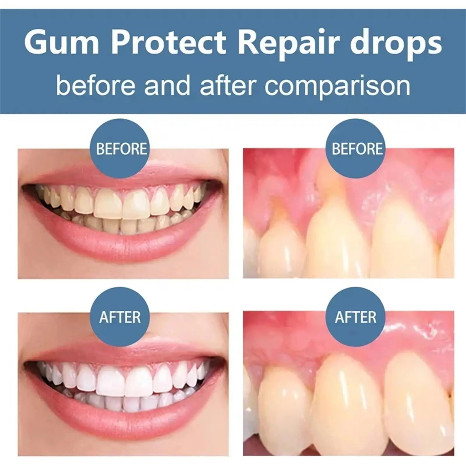 Damaged Gum Repair Care Toothpaste Relieve Sore Gums Allergy Deep Cleaning Teeth Stains Tartar Serum Dental Caries Toothpaste Qme