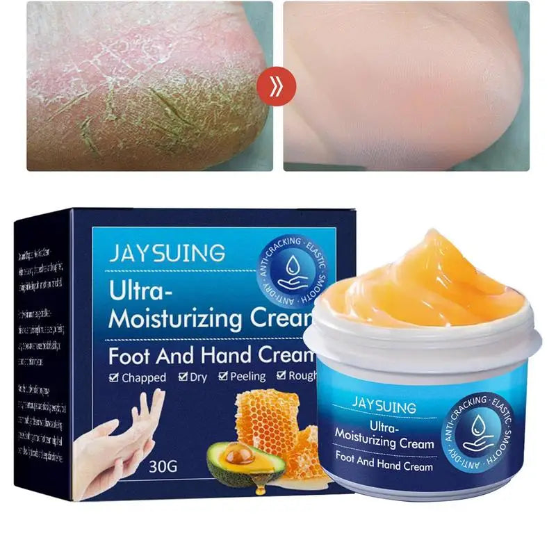 Anti-crack Hand Care Cream Dry Cracked Hands Moisturizing Not-greasy Qme