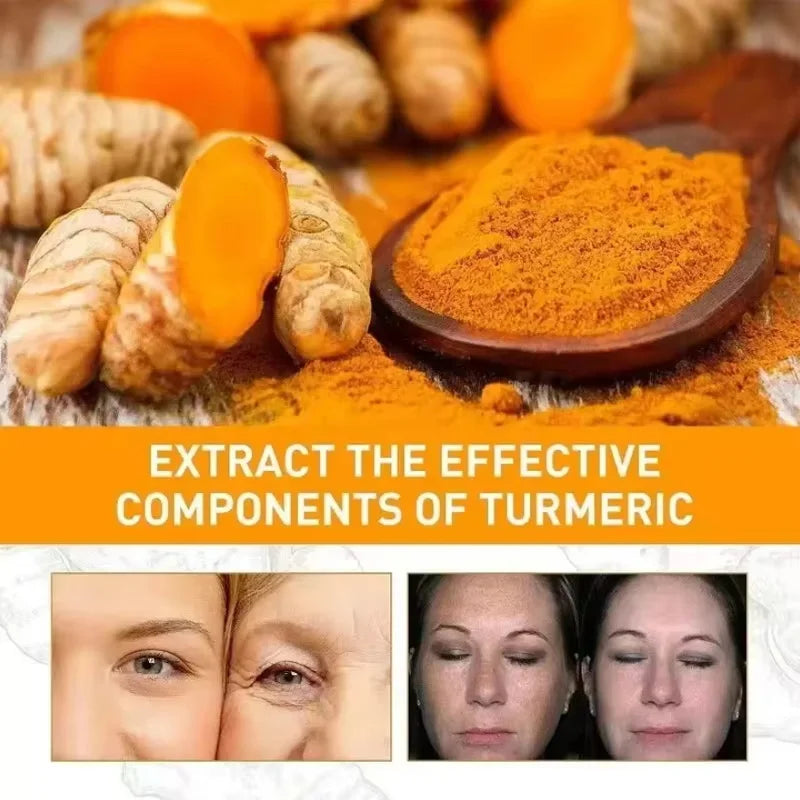 Turmeric Repair Essence For Reduces Dark Spots & Freckles Moisturizes Face Brightens And Evens Skin Tone Improves Damaged Skin Qme
