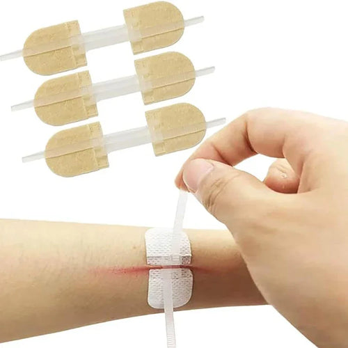 1 3 10 50 Patches Butterfly Closure Bandage Strips Adhesive Strip Qme