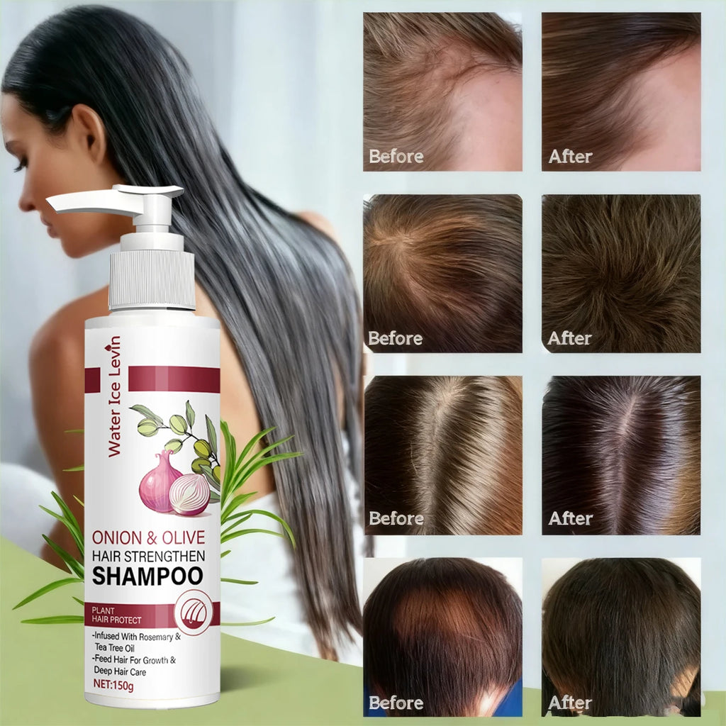 Onion & Olive Hair Strengthen Shampoo with Biotin & Rosemary Oil - Promotes Hair Growth & Deep Moisture for Dry, Damaged Hair Qme
