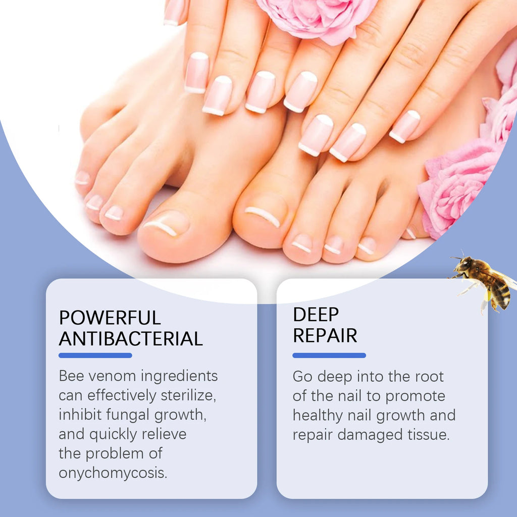 Bee Venom Nail Fungus Care Solution Maintenance Repair Nail Discoloration Thick Hand Foot Nail Manicureed Health Care Essence Qme