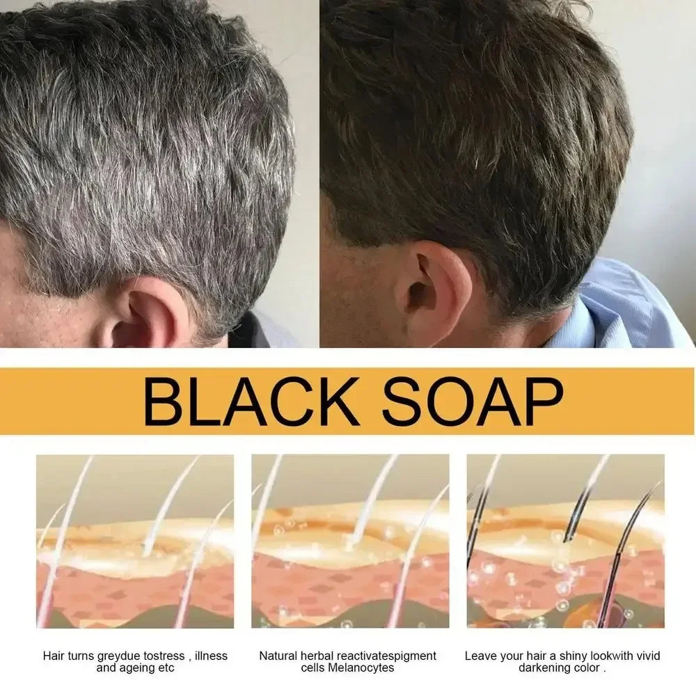 Polygonum Multiflorum Black Hair Soap Darkening Shampoo Bar Repair Gray White Color Dye Face Hair Body Shampoo For Man Women Qme