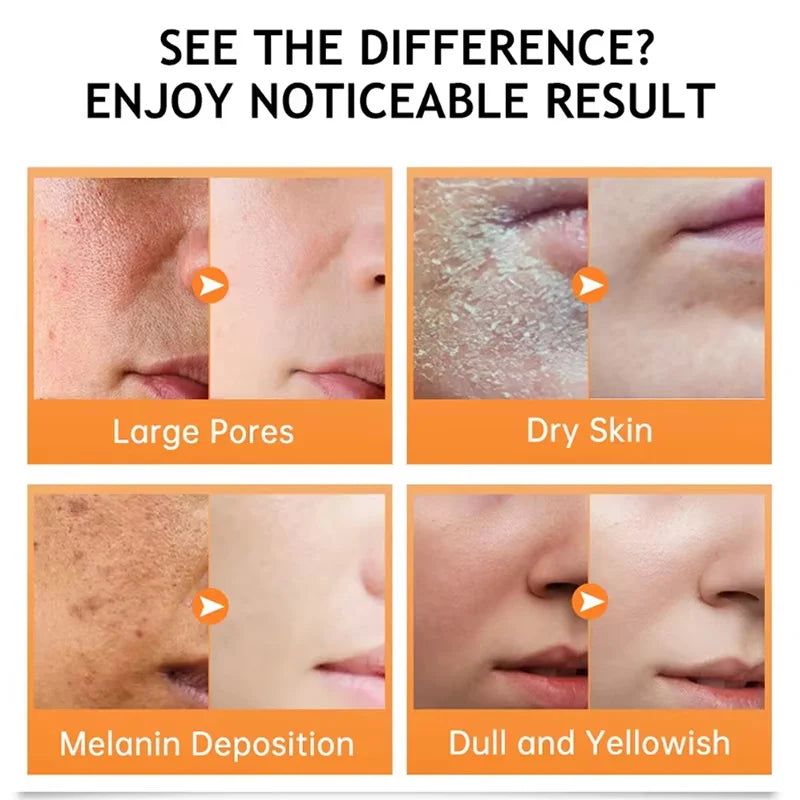 Turmeric Repair Essence For Reduces Dark Spots & Freckles Moisturizes Face Brightens And Evens Skin Tone Improves Damaged Skin Qme