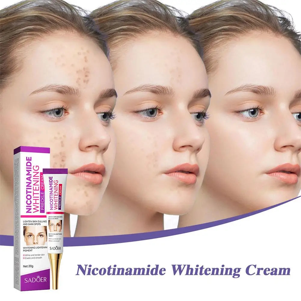 3pcs Nicotinamide Whitening Freckles Cream Remove Melasma Dark Spot Acne Marks Brightening Skin Tone Face Skin Care Qme