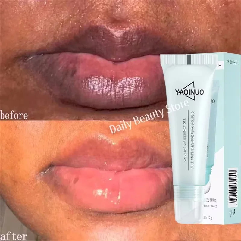 Remove Dark Lip Balm Fast Lightening Pink Lip Exfoliating Fade Lip Line Dead Skin Moisturizer Korean Care Products Beauty Health Qme 1pc