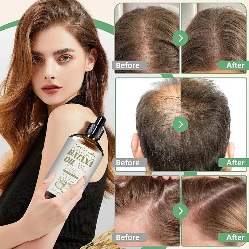 Volumizing Batana Oil Hair Treatment - Strengthening & Moisturizing with Coconut & Jojoba Oils for All Hair Types - Adds Shine Qme