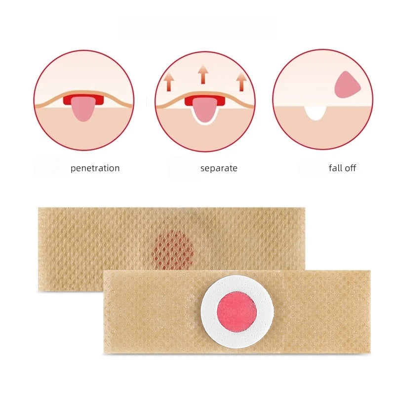 Corn Remouer Pads Corn Removal Pads Curative Patches Painless Calluses Remove Corn Plaster Corn Remover Feet Callus Corn Sticker Qme