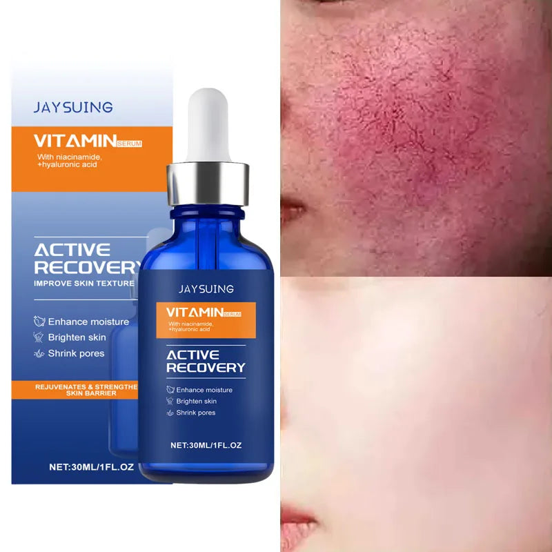 Facial Redness Repair Essence Improve Sensitive Skin Dryness Moisturizer Hydrating Sooth Lotion Removal Rosacea Korean Cosmetics Qme