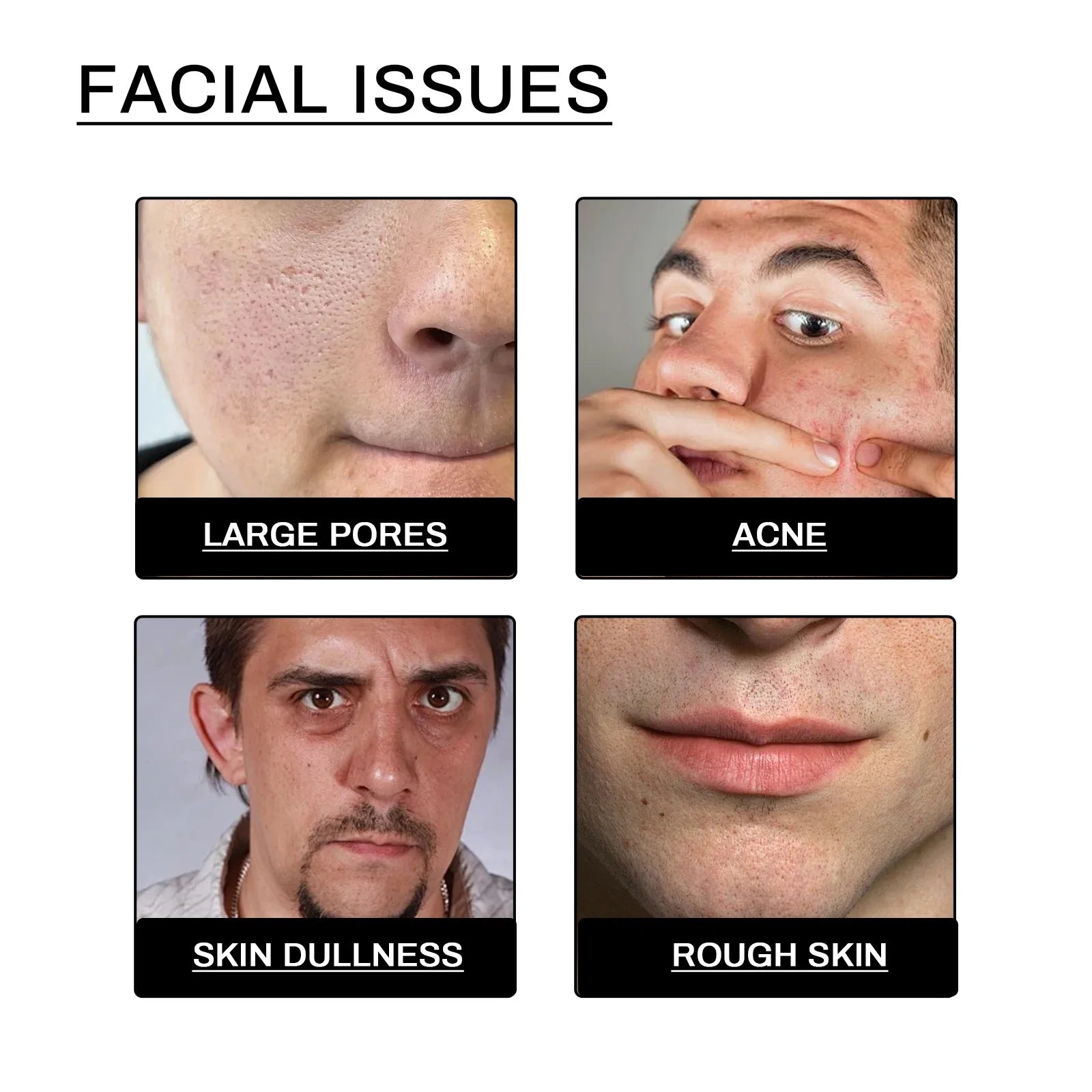 Men's Daily Face Wash Deep Cleansing Pore Oil Control Remove Acne Blackhead Brightening Facial Cleanser for Refreshed Skin Qme