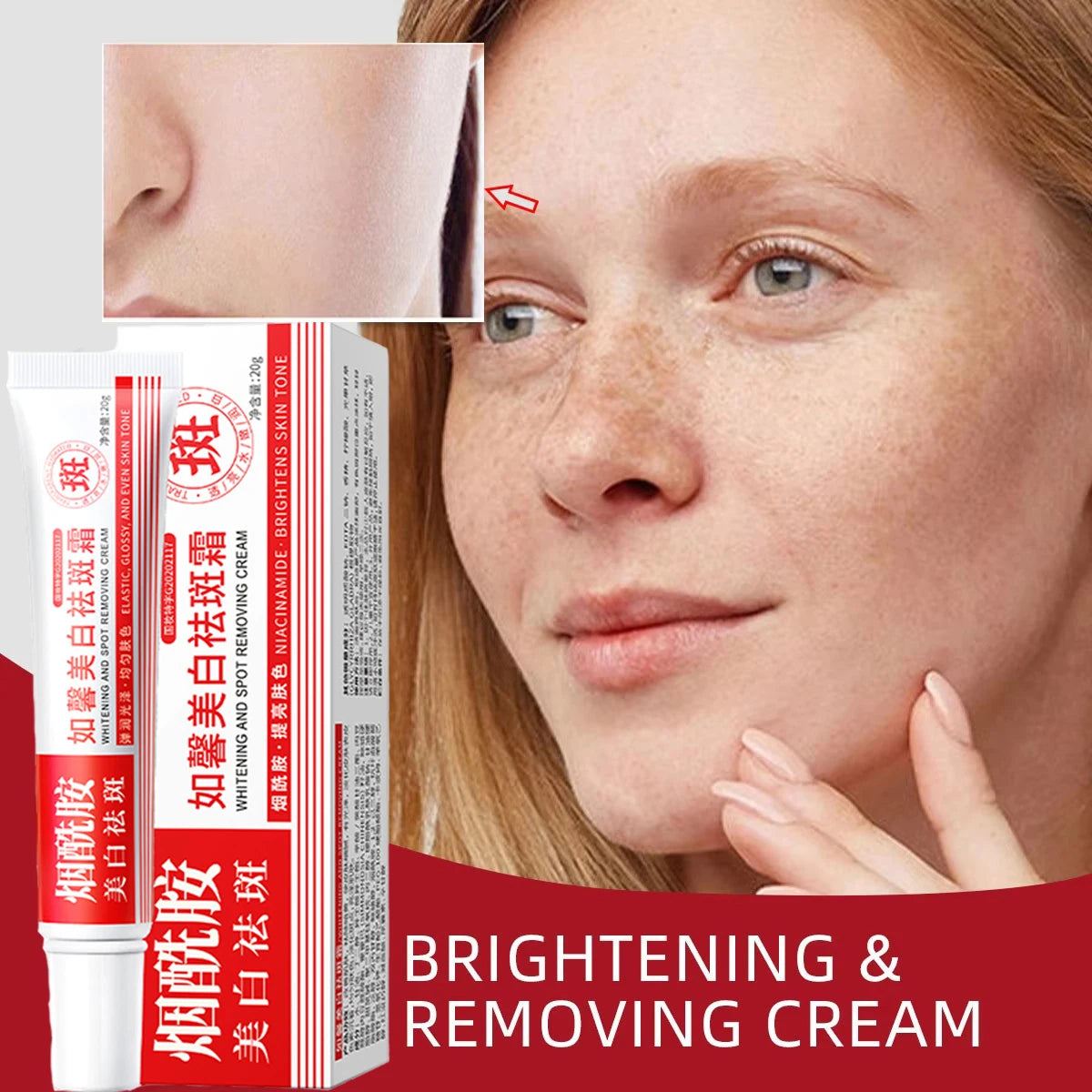 Face Cream Remove The Black Melasma Deposits On The Skin Brightening Skin Care Qme
