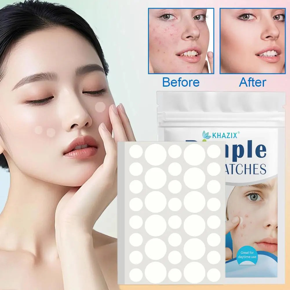 Transparent Acne Patch Concealer - Invisible Acne Patch For Women, Mild Skin-Friendly Tool For Face Cleaning, Targets Black X5R8 Qme