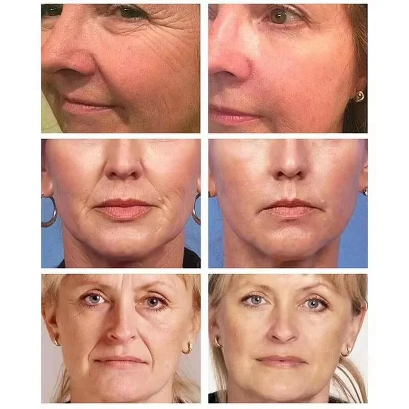Retinol Wrinkle Removing Face Cream Anti-Aging Firming Lifting Fade Fine Lines Moisturizing Brighten Skin Care Korean Cosmetics Qme