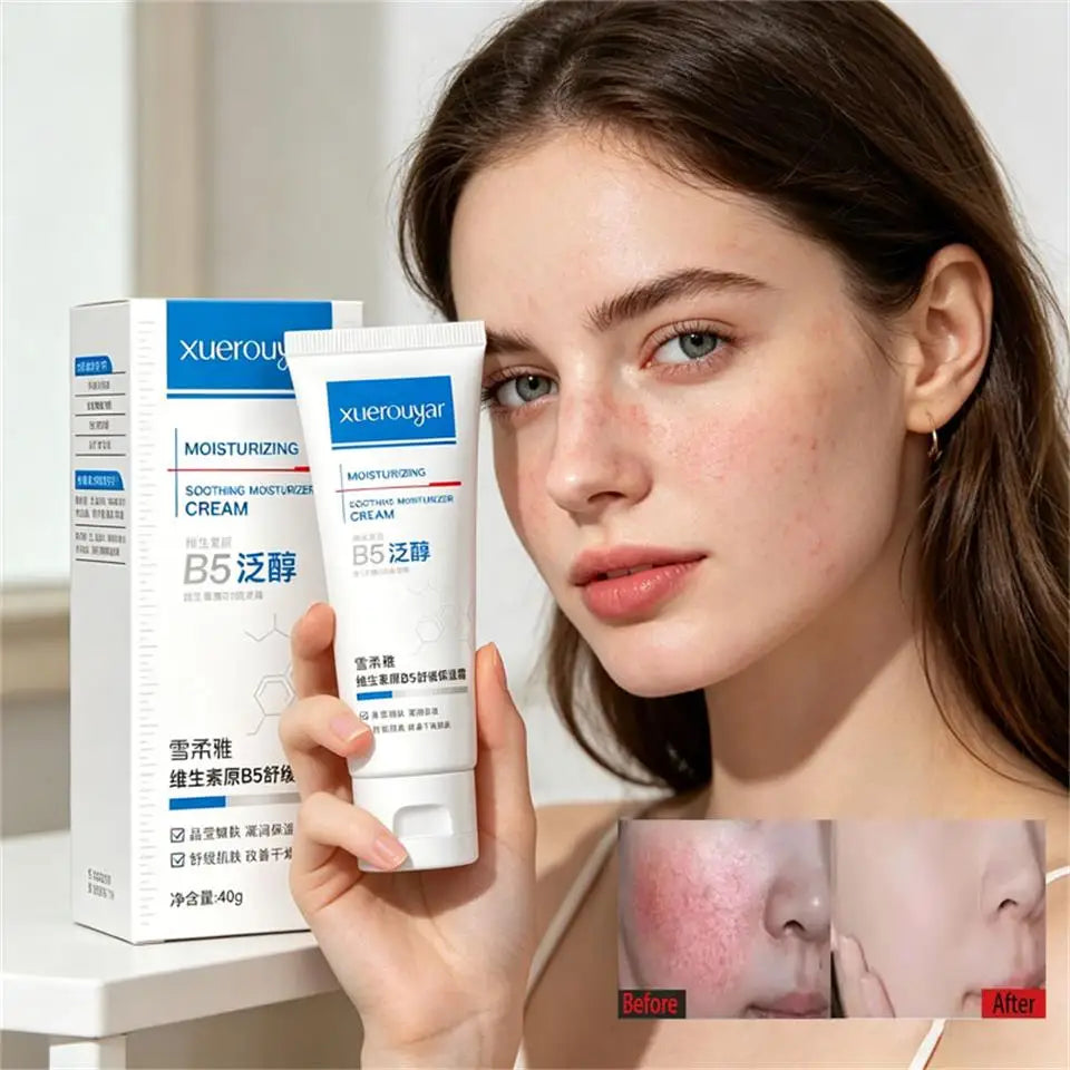 B5 Faded Facial Redness Cream Instant Spider Vein Remove Sensitive Skin Sooth Anti Redness Rosacea Treat Lotion Korean Cosmetic Qme