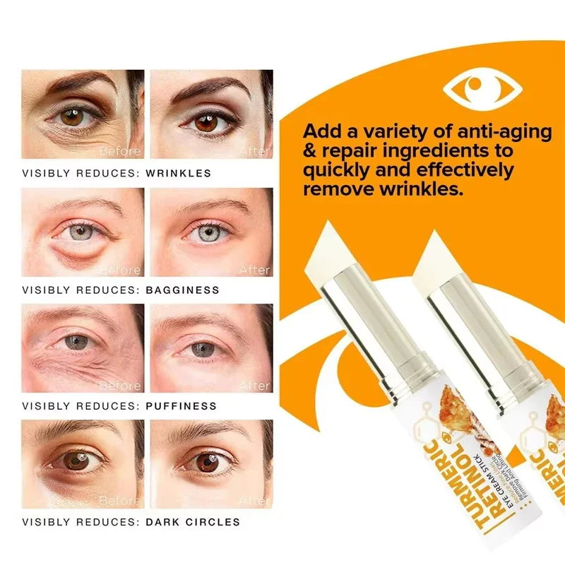 Instant Eye Bag Remove Eye Cream Anti Fat Particles Dark Circles Puffiness Fade Fine Lines Lift Brighten Korean Beauty Eye Care Qme