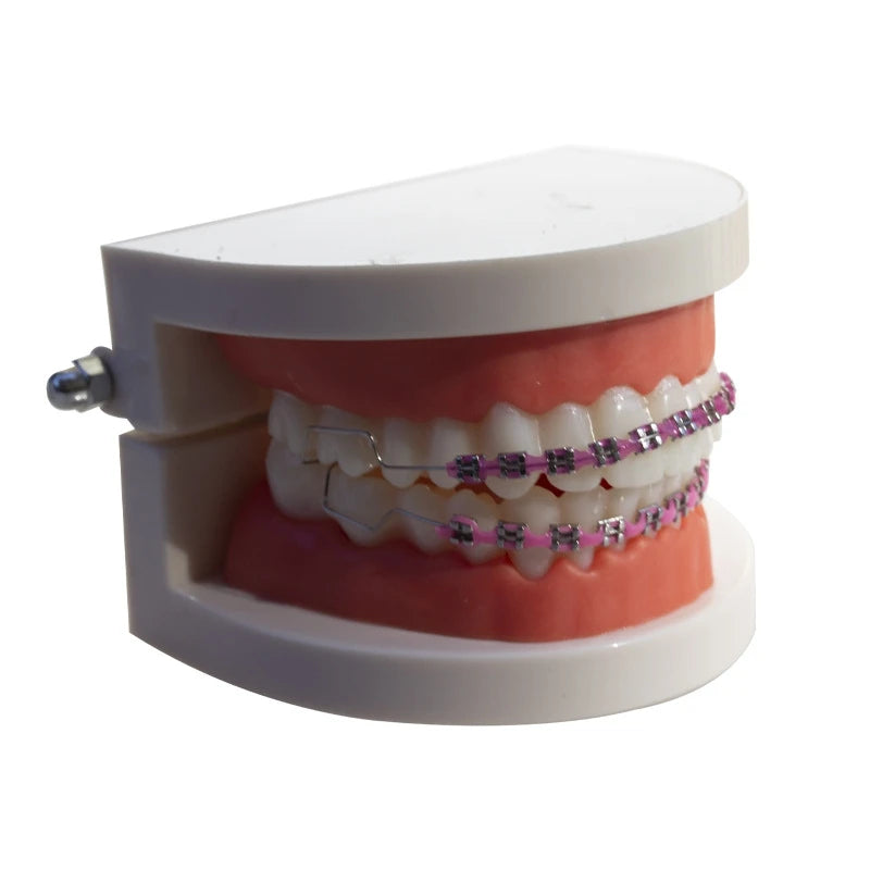 Universal Orthodontic Brackets Invisible Orthodontic Aligners Fashion Braces Teeth Temporary Braces Orthodontics Dental Braces Qme