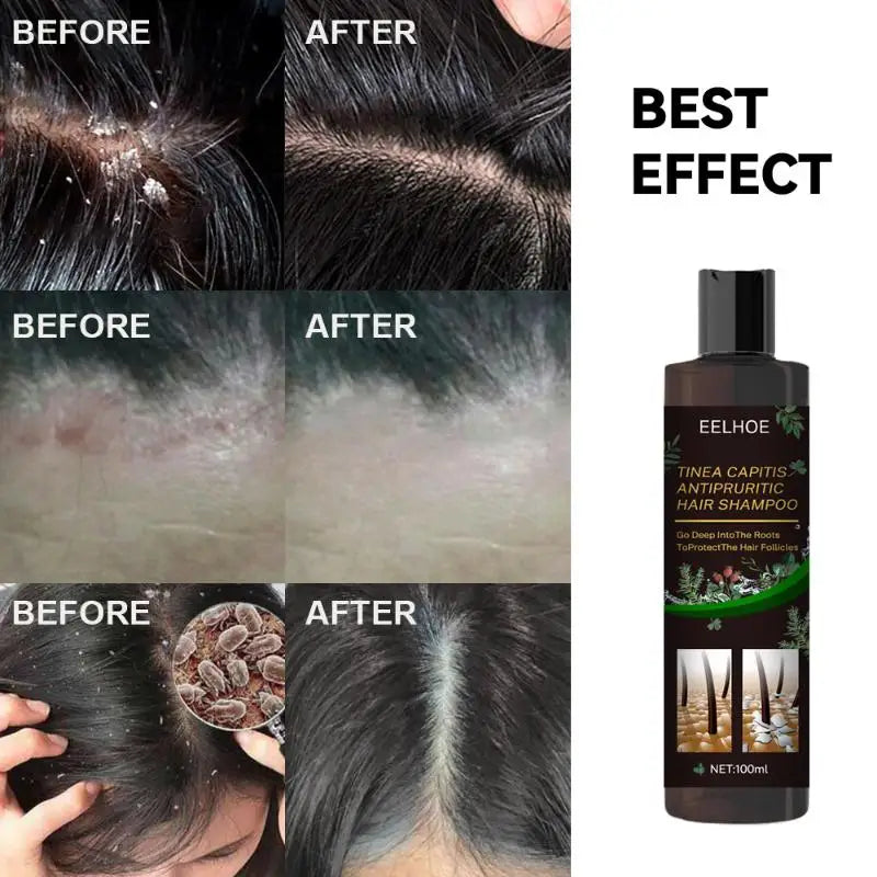 Professional Herbal Hair Shampoo Deep Moisturizing Nourishing Scalp Qme
