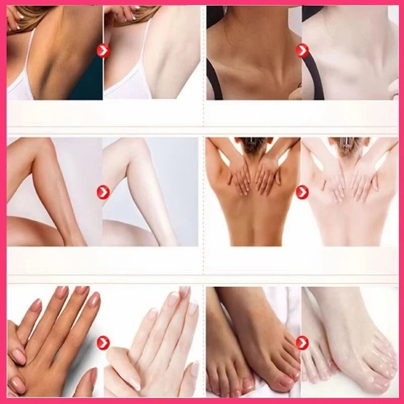 Body Whitening Cream Arms Thighs Underarm Knees Whitening Essence Cream Brighten Moisturizing Body Korean Skin Care Products Qme