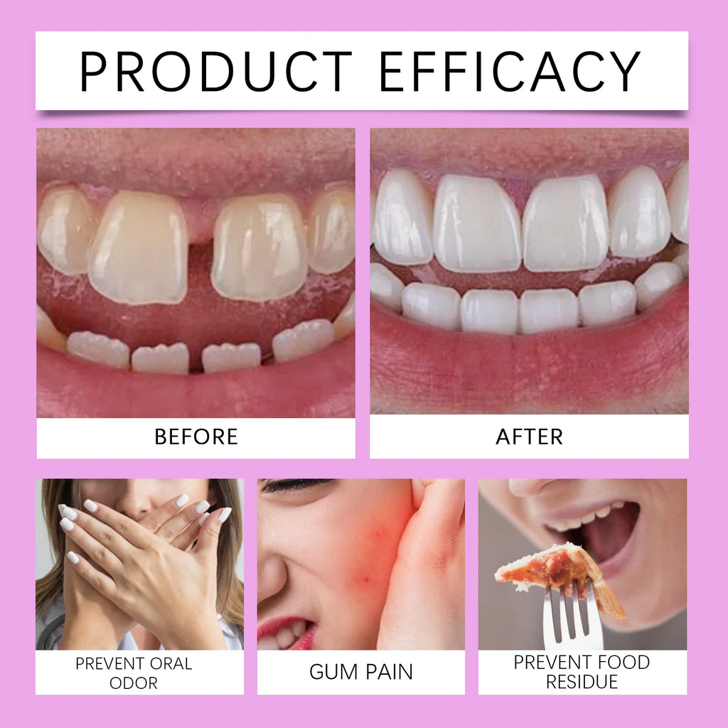 Oralhoe Denture Adhesive Cream Particularly Sturdy False Teeth Glue for Dentures Fixing Prevent Loosen Temporary Dental Adhesive Qme