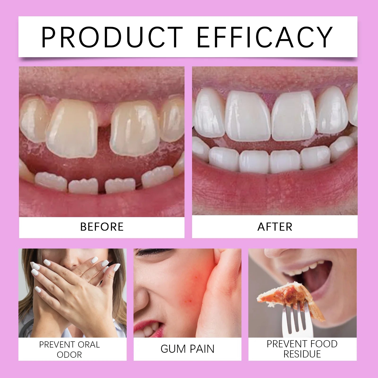 Oralhoe Denture Adhesive Cream Particularly Sturdy False Teeth Glue for Dentures Fixing Prevent Loosen Temporary Dental Adhesive Qme