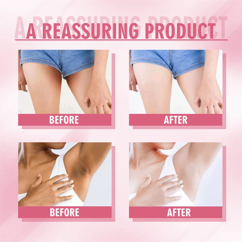 Skin Whitening Serum Private Parts Underarm Bleaching Serum Whiten Butt Knee Brighten Inner Thigh Arm Body Remove Dark Melanin Qme