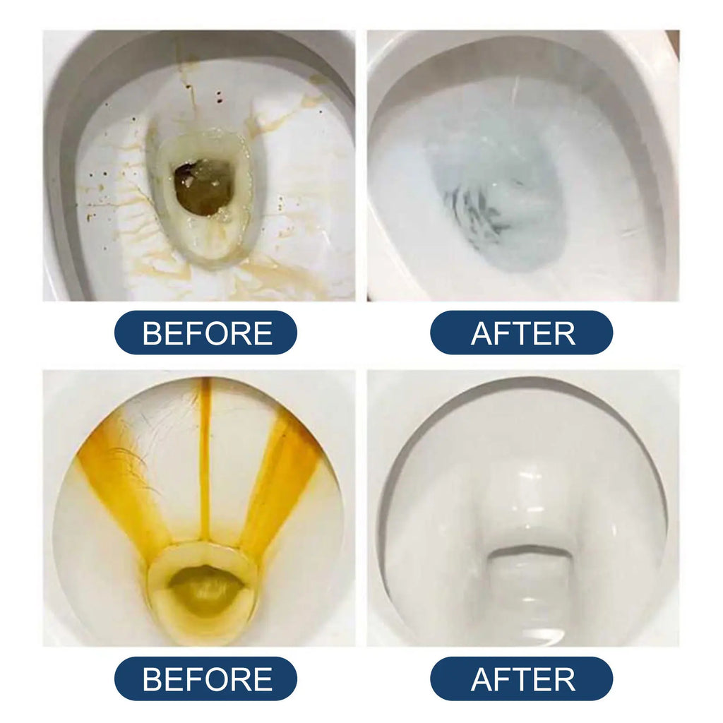 Toilet Effervescent Tablets Remover Urine Stain Deodorant Yellow Dirt Cleaning Bathroom Detergent Toilet Decontaminate Cleaner Qme