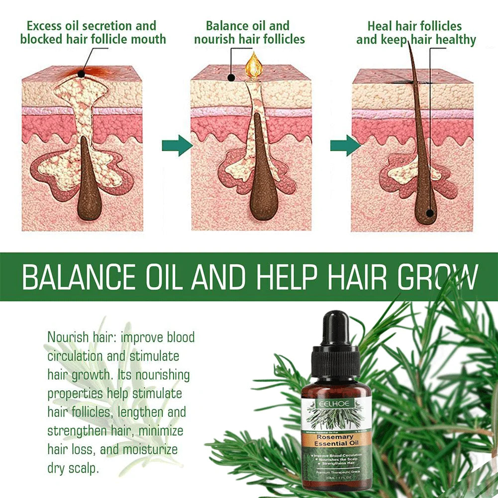 Rosemary Oil Hair Growth Essential Coconut Improve Loss Nourishes Qme