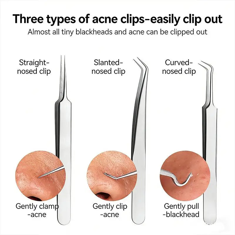 Ultra-precise Acne Blackhead Removal Tool Pimple Tweezers Effective Qme