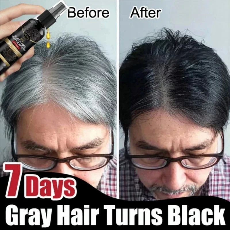 Gray White Hair Treatment Serum Cover White Hair To Black Natural Color Repair Spray Anti Loss Hair Restore Healthy Care Qme