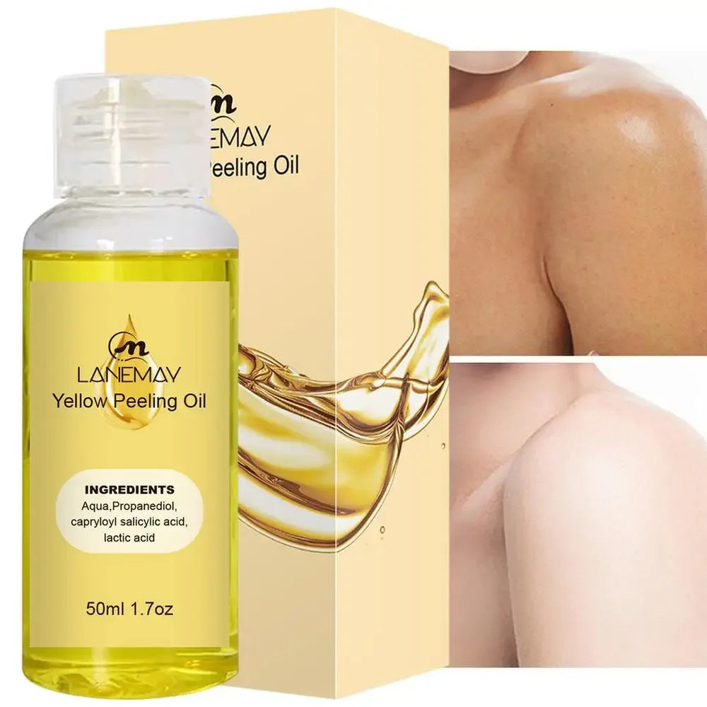 Yellow Peeling Oil Lighten Elbows Knees Hands Melanin Strong Yellow Peeling Oil Even Skin Tone And Whiten Skin Care Supplies Qme