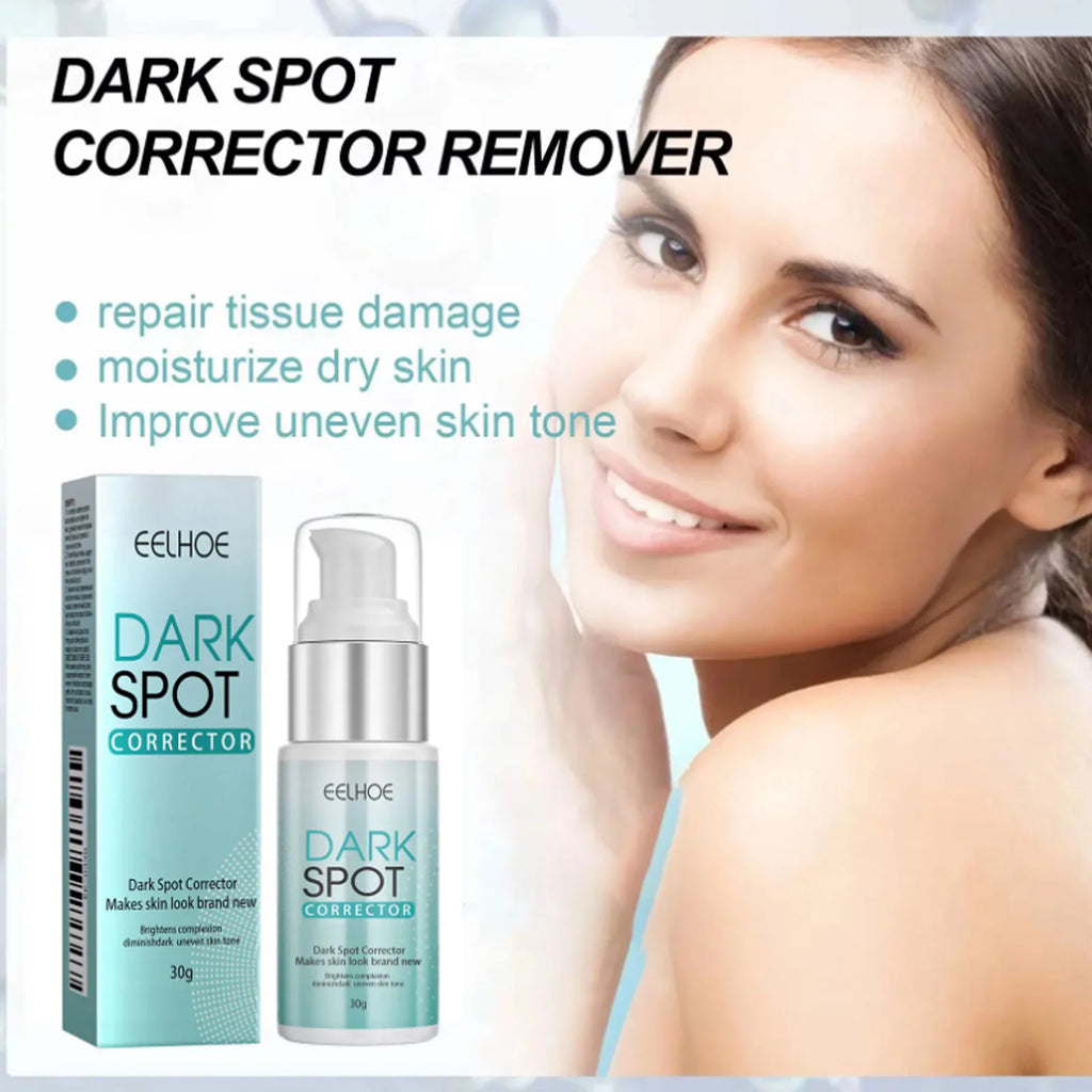 Freckle Whitening Cream Nicotinamide Fade Dark Spot Blemish Acne Mark Brightening Lightening Pigmentation Correction Cream Qme