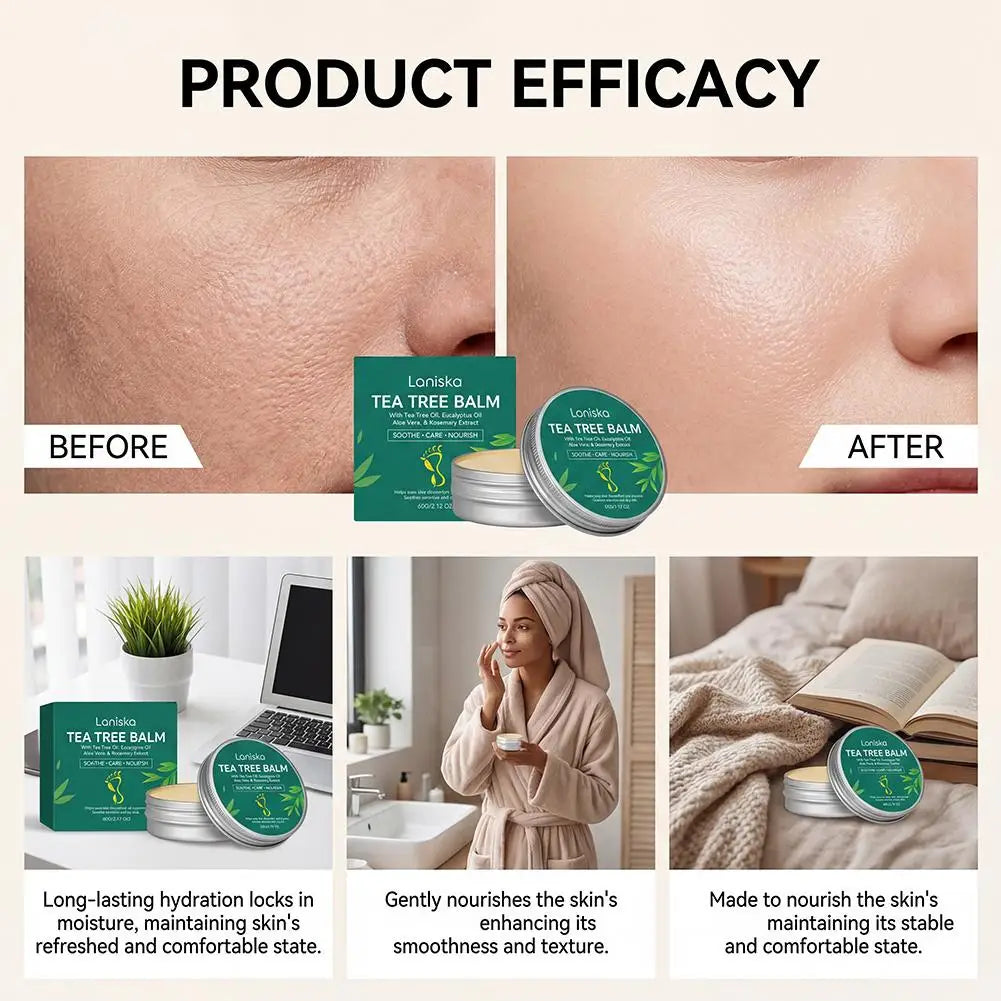 Moisturizing Cream Dry Skin Rough Hands Cracked Heels Cuticles Feet Qme