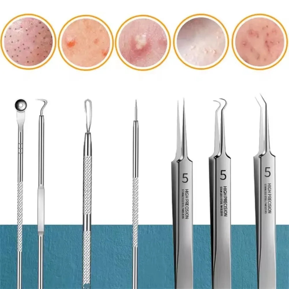 Acne Needle Blackhead Clip Remover Extraction Pore Black Head Clean Qme