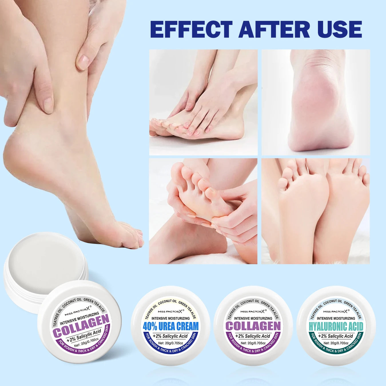 3PCS/Box Urea Foot Cream Moisturizer, with Salicylic Acid, for Dry and Cracked Feet - Hand and Foot Care for and Women Qme