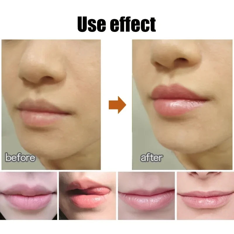 Cute Ball Shaped Lip Balm Hydrating Soothing Long-lasting Plumper Qme
