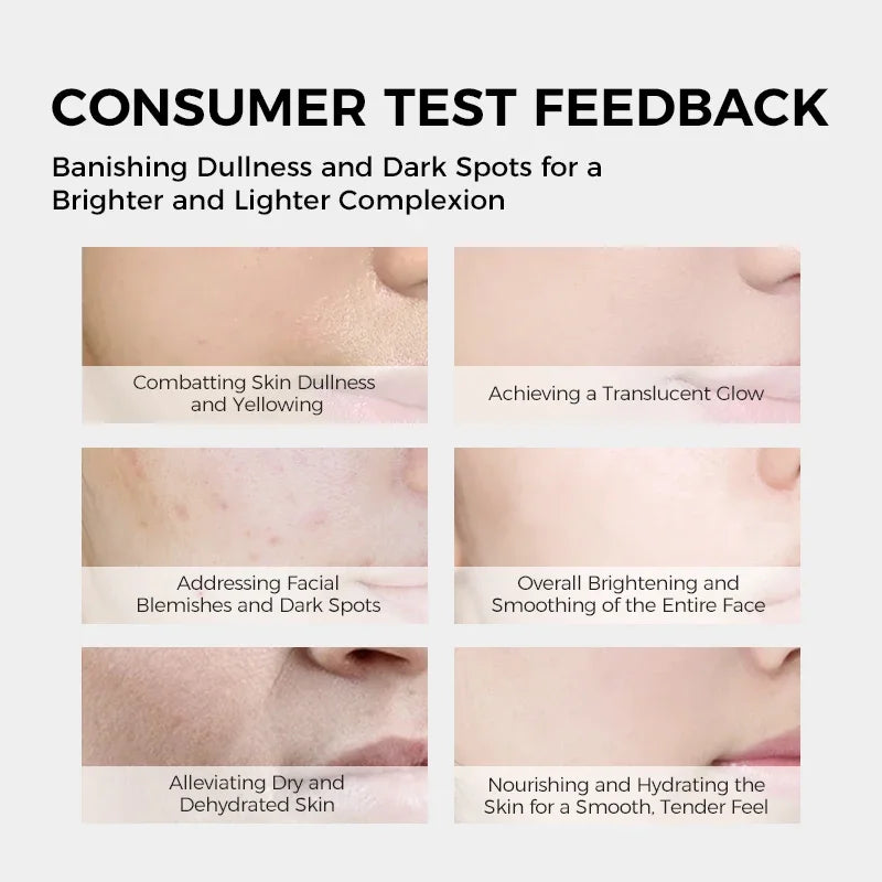 EXPRESSIONS Brightening Anti-blemish Facial Mask Niacinamide Qme