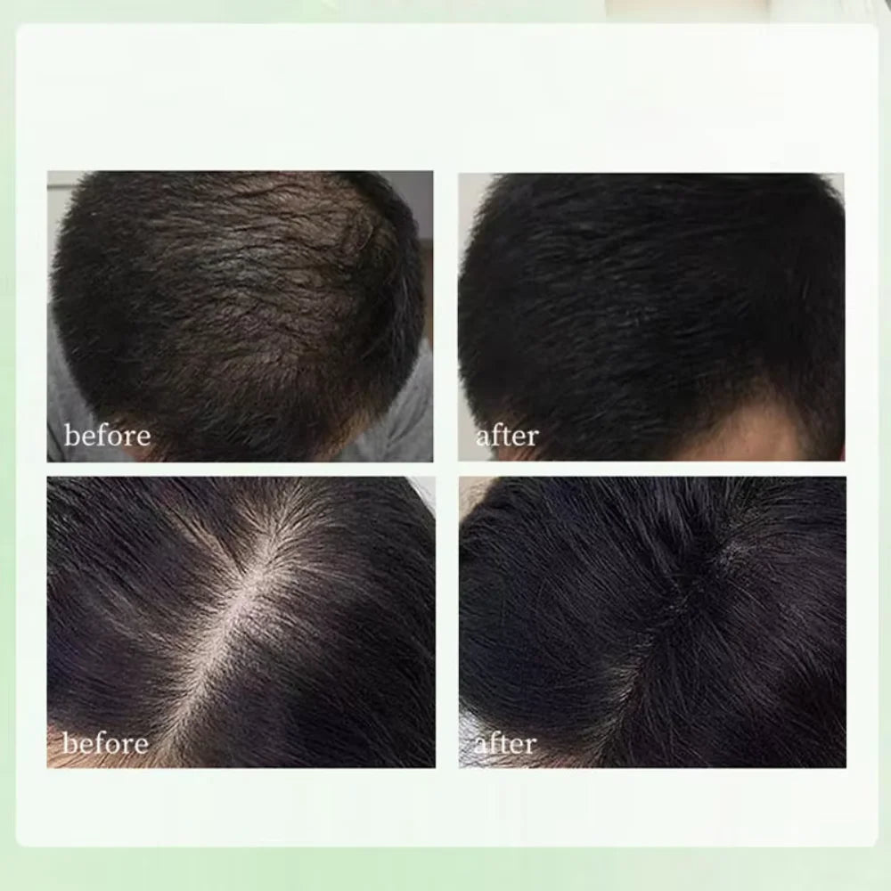 Natural Herbal Shampoo Soap Usman Grass Handmade Hair Nourishing Oil Qme