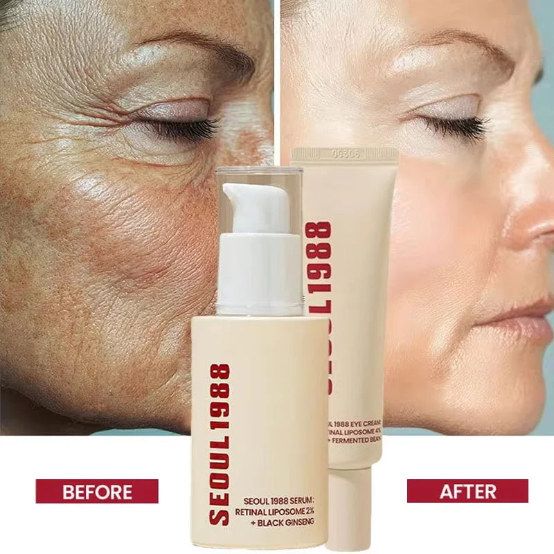 Seoul 1988 Retinol Ginseng Eye & Face Cream Serum Set Firming Moisturizing Diminish Lines Wrinkles Skin Care Essences Qme 1 set