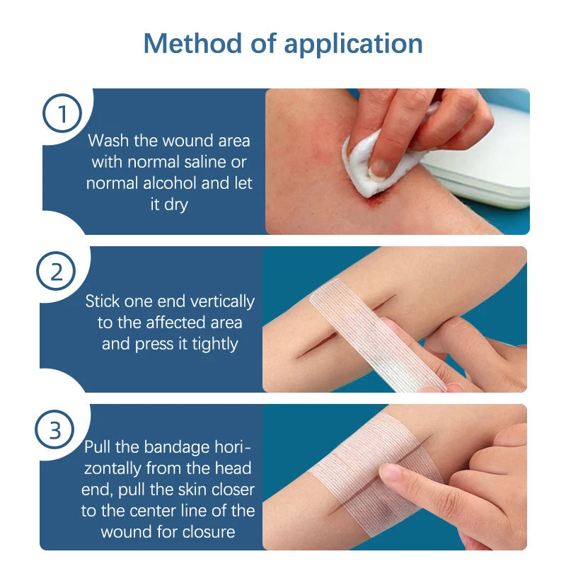 Sterile 2 3 5 Strip Adhesive Surgical Tape Wound Closure Breathable Qme