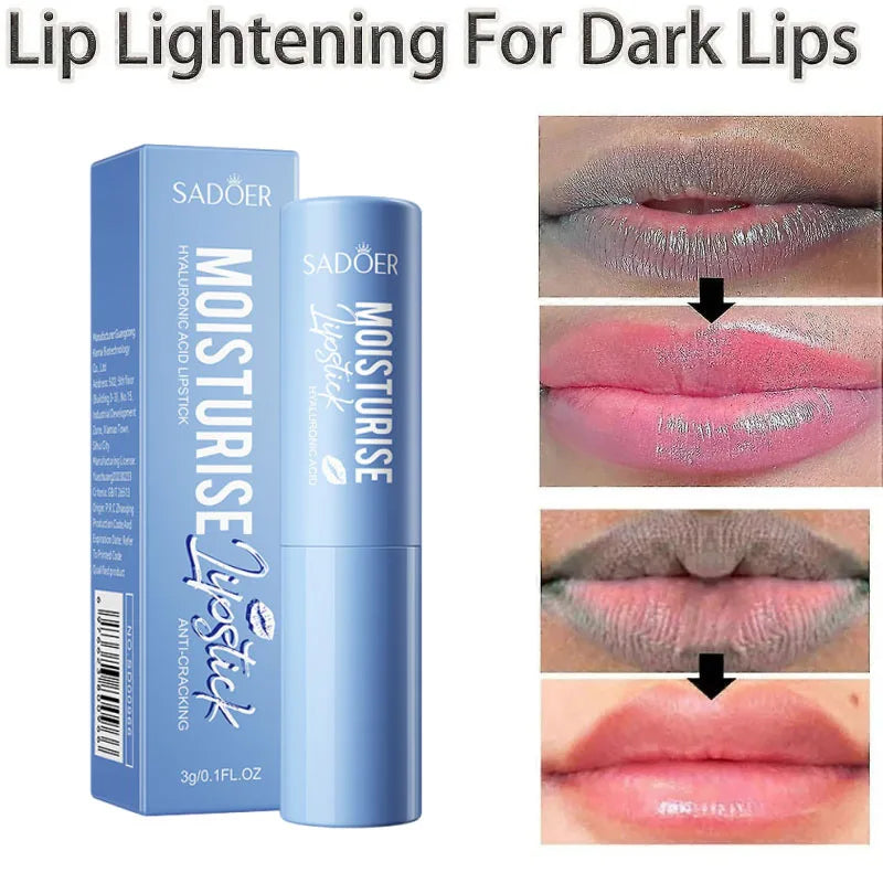 Remove Dark Lip Balm Fast Lightening Pink Lip Exfoliating Fade Lip Line Dead Skin Moisturizer Korean Care Products Beauty Health Qme