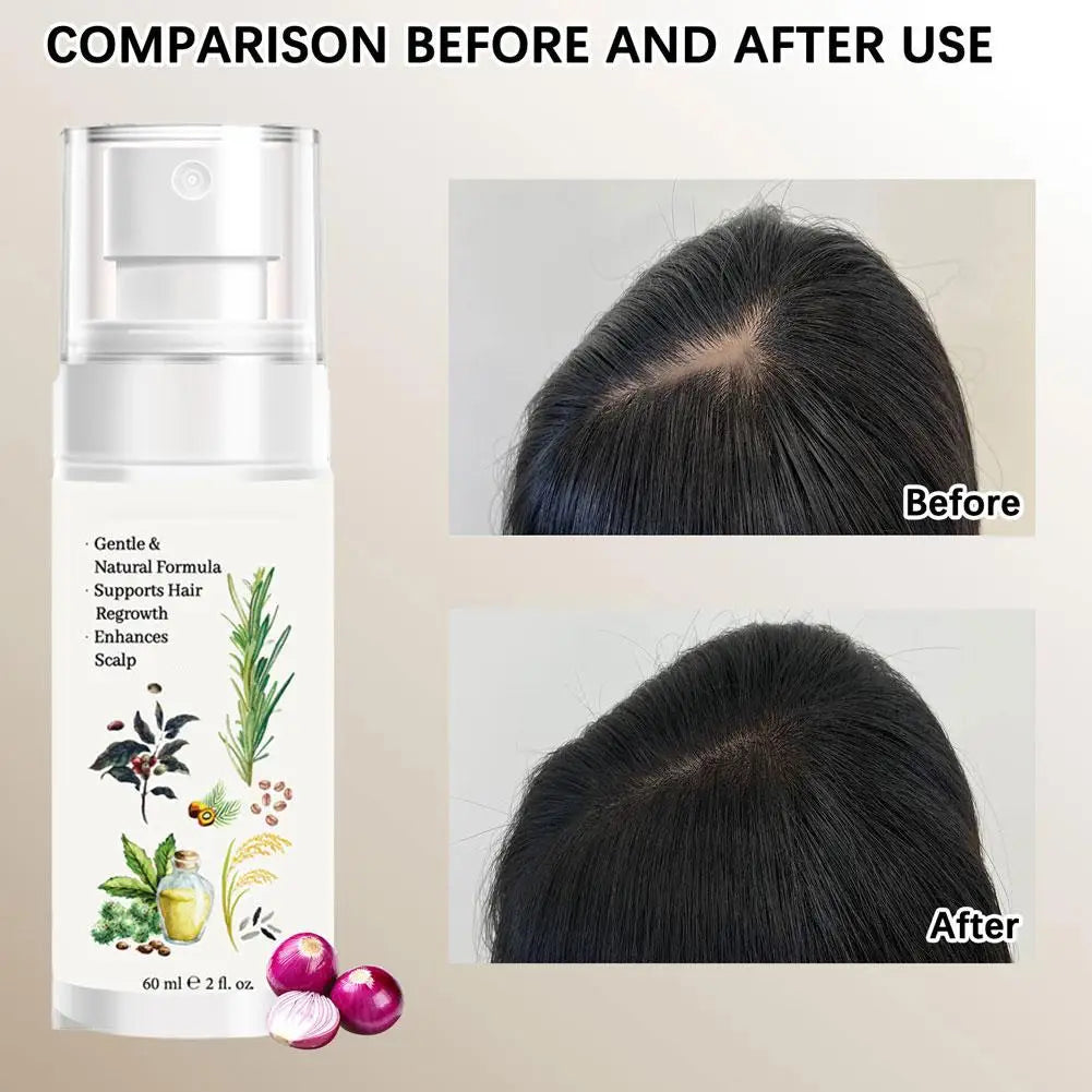 Hair Strengthening Serum - Scalp Nourishing Adds Volume, Hydrates Dry Hair, And Enhances Shine Dry Hair Qme