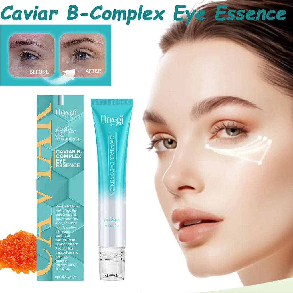 Caviar B-Complex Eye Essence Remove Dark Clrcles Anti Puffiness Smoothing Fine Lines Moisturize Skin Around the Eye Serum Qme