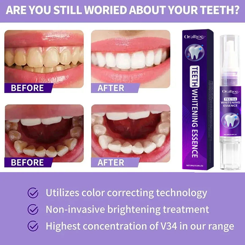 Bee Venom Toothpaste Dental Care Gel Deep Cleaning Removes Tooth Stains Fresh Breath Protect Oral Health Mint Fresh Toothpaste Qme