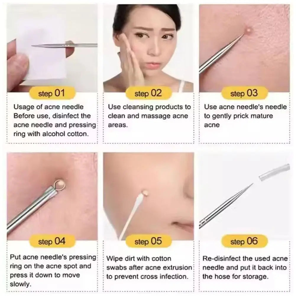 Blackhead Remover Tool Curved Tweezers Acne Needle Pimple Popper Qme