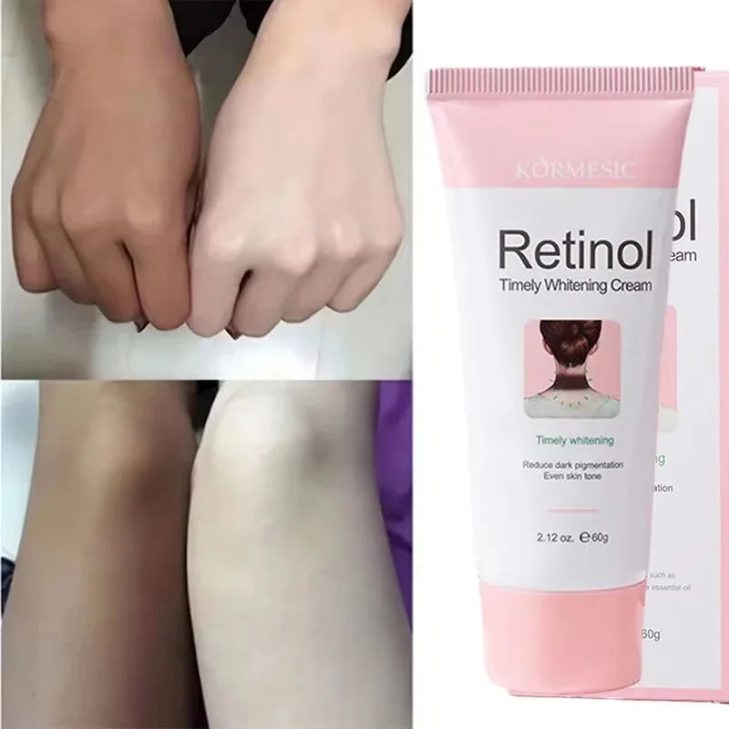 Retinol Whitening Cream Private Parts Underarm Bleaching Neck Lift Firm Butt Knee Brighten Inner Thigh Dark Remove Melanin 60g Qme